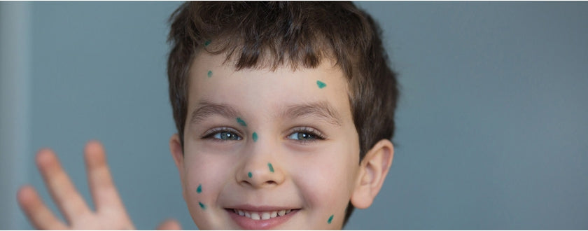 Combattre le Molluscum Contagiosum au naturel