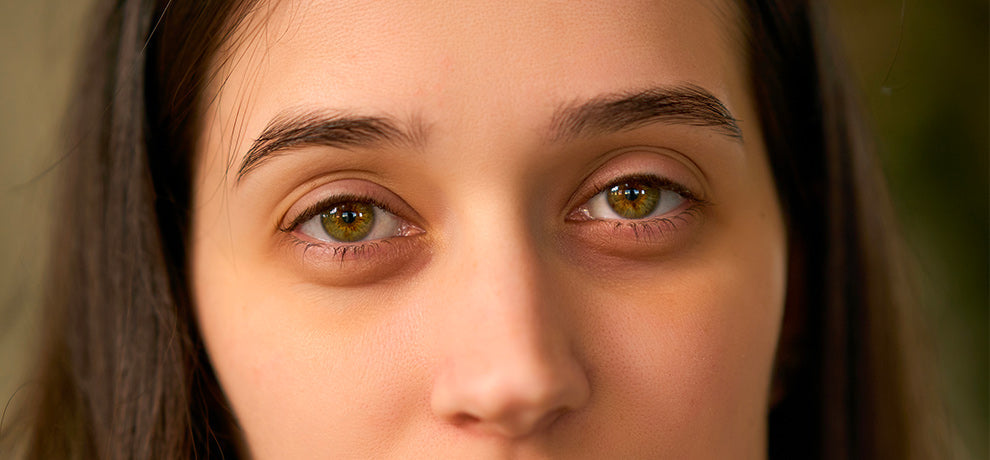 Comment atténuer ses cernes avec les huiles essentielles ?