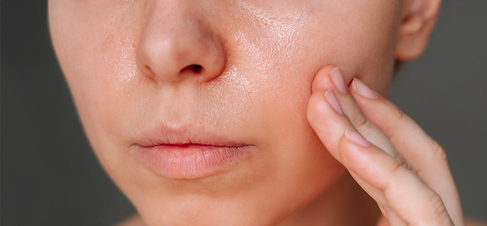 Comment réduire l’excès de sébum naturellement ?