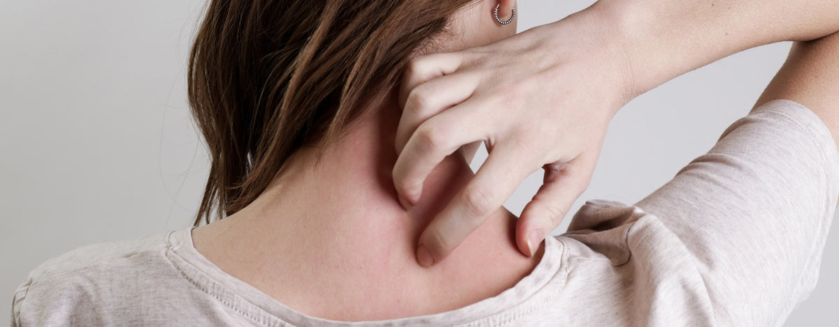 Traiter l'eczéma avec les huiles essentielles